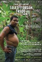 人体器官交易实录